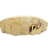 Polished Grillz Top 2pc
