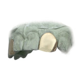 Incisors with Back Bar Top or Bottom 2pc