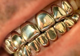Florida Style Perm Cut Grillz Set