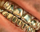 perm cut grillz  yellow