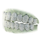 Honeycomb VS Diamond Grillz Set 10 on 10