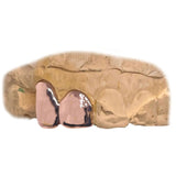 Polished Grillz Top 2pc