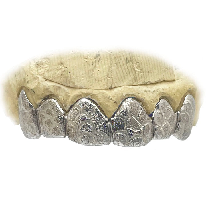 Diamond dust white hot sale gold grillz