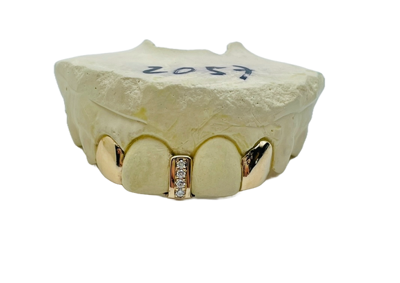 Diamond Gap Grillz