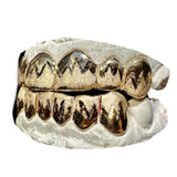 Deep Cut Grillz With Leaf Cuts And Diamond Dust Top Or Bottom