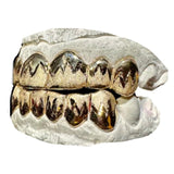 Deep Cut Grillz With Leaf Cuts And Diamond Dust Top & Bottom Set
